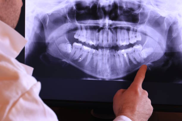 Best Urgent Care for Lost Fillings or Crowns in Seabrook, SC