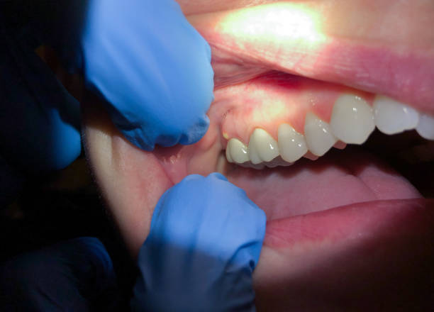 Best Weekend Emergency Dentist in Seabrook, SC
